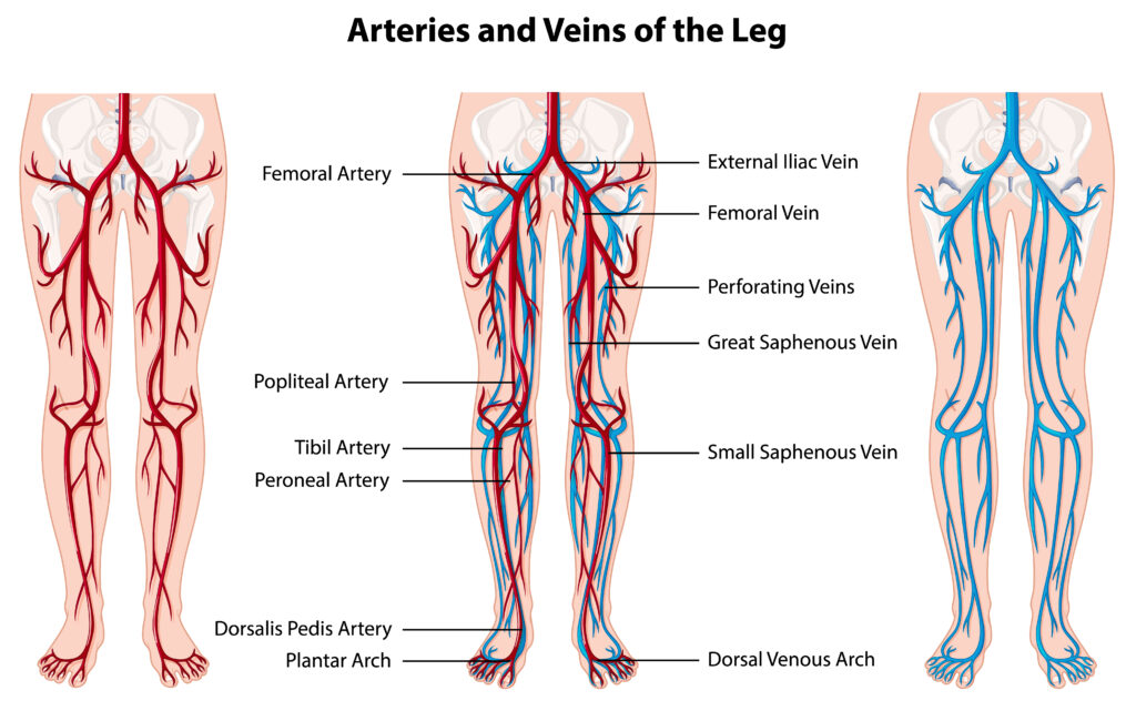 Vein Thrombosis